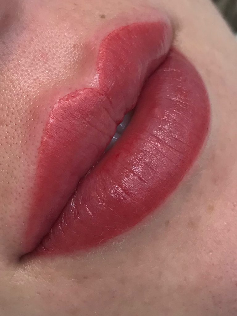 sweet lips sallus estetica
